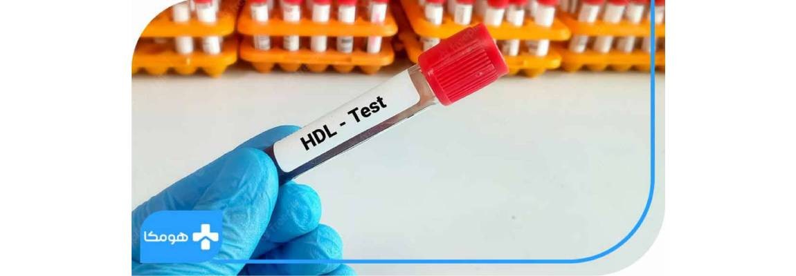 ازمایش HDL