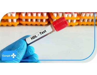 کاهش خطر سکته قلبی با آزمایش HDL!
