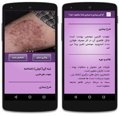 آشنایی با بیماری های پوستی